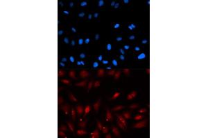 Immunofluorescence analysis of U2OS cells using PA2G4 antibody (ABIN5973112). (PA2G4 抗体)