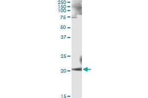 Immunoprecipitation of ANK1 transfected lysate using anti-ANK1 monoclonal antibody and Protein A Magnetic Bead , and immunoblotted with ANK1 MaxPab rabbit polyclonal antibody. (Erythrocyte Ankyrin 抗体  (AA 1-155))