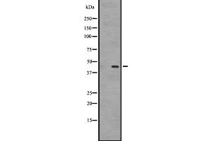Western blot analysis of GPR87/GPR95 expression in A431 whole cell lysate ,The lane on the left is treated with the antigen-specific peptide. (GPR87 抗体  (C-Term))