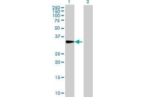 Western Blot analysis of CISH expression in transfected 293T cell line by CISH MaxPab polyclonal antibody. (CISH 抗体  (AA 1-258))