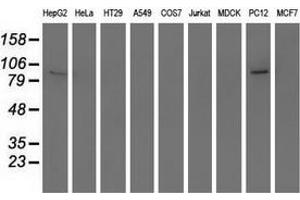 Western blot analysis of extracts (35 µg) from 9 different cell lines by using anti-RASD2 monoclonal antibody. (RASD2 抗体)