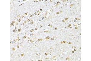 Immunohistochemistry of paraffin-embedded Rat brain using KU70 Polyclonal Antibody at dilution of 1:100 (40x lens). (XRCC6 抗体)