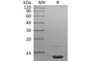 Western Blotting (WB) image for Complement Component 3 (C3) protein (ABIN7320494) (C3 蛋白)