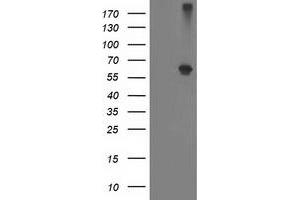 Western Blotting (WB) image for anti-Alcohol Dehydrogenase 1B (Class I), beta Polypeptide (ADH1B) antibody (ABIN1496479) (ADH1B 抗体)