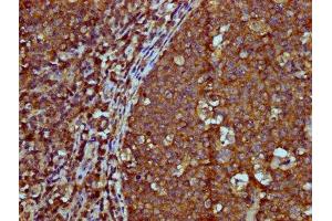 IHC image of ABIN7156089 diluted at 1:600 and staining in paraffin-embedded human tonsil tissue performed on a Leica BondTM system. (IGHM 抗体  (AA 45-178))