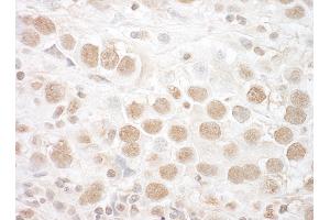 anti-Catenin, beta Like 1 (CTNNBL1) (AA 1-50) antibody