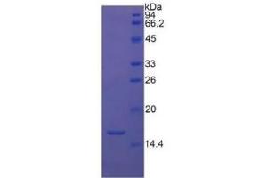 SDS-PAGE of Protein Standard from the Kit (Highly purified E. (TGFB1 CLIA Kit)