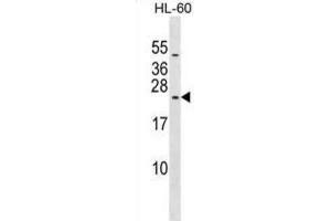 Western Blotting (WB) image for anti-Ribosomal Protein L10L (RPL10L) antibody (ABIN2999579) (RPL10L 抗体)