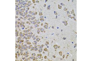 Immunohistochemistry of paraffin-embedded mouse brain using PIK3CA antibody (ABIN5970095) at dilution of 1/100 (40x lens). (PIK3CA 抗体)