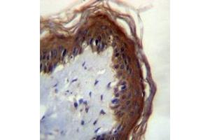 Immunohistochemistry analysis in formalin fixed and paraffin embedded human skin tissue reacted with LIPM Antibody (C-term) followed by peroxidase conjugation of the secondary antibody and DAB staining. (LIPM 抗体  (C-Term))