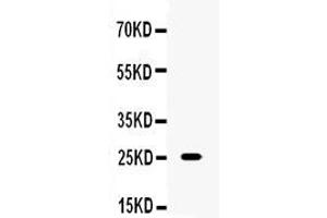 Western blot analysis of TNF alpha using anti-TNF alpha antibody . (TNF alpha 抗体  (C-Term))