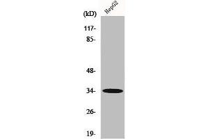 Western Blot analysis of HepG2 cells using Chemokine Receptor D6 Polyclonal Antibody (CCBP2 抗体  (C-Term))