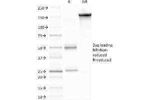 SDS-PAGE Analysis of Purified MMP9 Mouse Monoclonal Antibody (2C3).