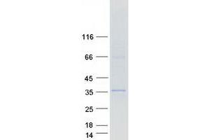 Western Blotting (WB) image for Armadillo Repeat Containing 10 (ARMC10) protein (Myc-DYKDDDDK Tag) (ABIN2714922)