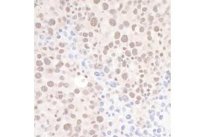 anti-DEAH (Asp-Glu-Ala-His) Box Polypeptide 8 (DHX8) (AA 325-375) antibody