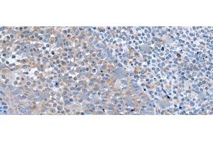 Immunohistochemistry of paraffin-embedded Human tonsil tissue using ZIC1 Polyclonal Antibody at dilution of 1:65(x200) (ZIC1 抗体)