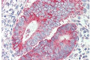 Immunohistochemistry (IHC) image for anti-Purinergic Receptor P2X, Ligand-Gated Ion Channel, 4 (P2RX4) (Internal Region) antibody (ABIN987282)
