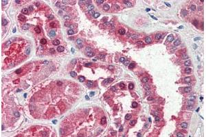 Human Kidney (formalin-fixed, paraffin-embedded) stained with GOT1 antibody ABIN337132 at 2. (GOT1 抗体  (AA 157-167))