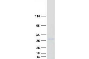 Validation with Western Blot (RCHY1 Protein (Transcript Variant 1) (Myc-DYKDDDDK Tag))