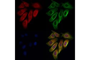 ABIN6262409 and ABIN6276925 staining Hela cells by IF/ICC.