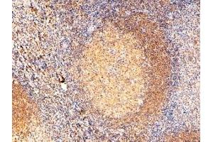 Immunohistochemistry (IHC) image for anti-Ras-Related C3 Botulinum Toxin Substrate 2 (Rho Family, Small GTP Binding Protein Rac2) (RAC2) (C-Term) antibody (ABIN184689)