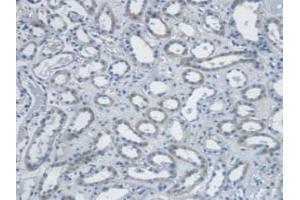 Detection of EDN1 in Human Kidney Tissue using Monoclonal Antibody to Endothelin 1 (EDN1) (Endothelin 1 抗体  (AA 53-90))