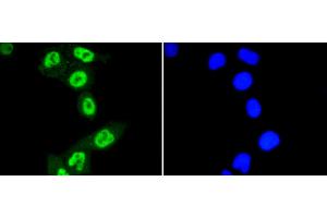 Immunofluorescence (Cultured Cells) (IF (cc)) image for anti-Signal Transducer and Activator of Transcription 3 (Acute-Phase Response Factor) (STAT3) (pSer727) antibody (ABIN5557530)