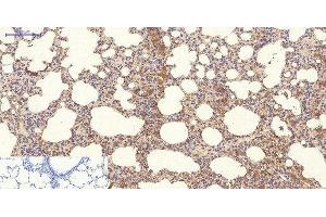 Immunohistochemistry of paraffin-embedded Rat lung tissue using NBR1 Monoclonal Antibody at dilution of 1:200. (NBR1 抗体)