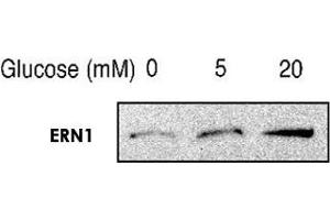 Western blot analysis of phosphorylated ERN1 in min6 cells, treated with glucose for 3 hours using ERN1 (phospho S724) polyclonal antibody . (ERN1 抗体  (pSer724))