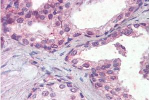 ABIN335143 (5µg/ml) staining of paraffin embedded Human Prostate. (IFNAR2 抗体  (Internal Region))