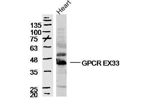 Mouse heart lysates probed with GPCR EX33 Polyclonal Antibody, unconjugated  at 1:300 overnight at 4°C followed by a conjugated secondary antibody at 1:10000 for 90 minutes at 37°C. (GPR84 抗体  (AA 21-120))