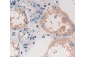 IHC-P analysis of Human Tissue, with DAB staining. (FCN3 抗体  (AA 34-297))