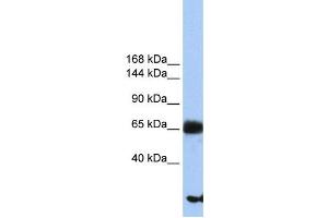 Western Blotting (WB) image for anti-Phosphatidylinositol Glycan Anchor Biosynthesis, Class O (PIGO) antibody (ABIN2459357) (PIGO 抗体)