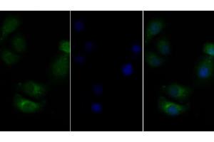 Detection of CSF2Rb in Human Hela cell using Polyclonal Antibody to Colony Stimulating Factor 2 Receptor Beta (CSF2Rb) (CD131 抗体  (AA 133-233))