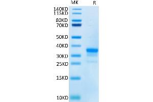 Cynomolgus CD40 on Tris-Bis PAGE under reduced condition. (CD40 Protein (CD40) (His tag))