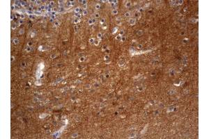 Image no. 1 for anti-Visinin-Like 1 (VSNL1) (AA 2-191) antibody (ABIN1491124) (VSNL1 抗体  (AA 2-191))