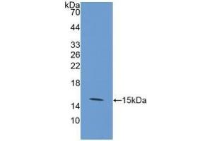 Detection of Recombinant GLUT1, Human using Polyclonal Antibody to Glucose Transporter 1 (GLUT1) (GLUT1 抗体  (AA 251-329))