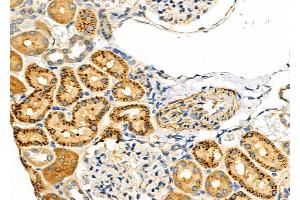 ABIN6258898 and ABIN6273902 at 1/100 staining Rat kidney tissue by IHC-P.