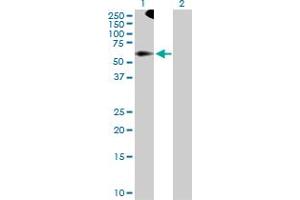 Western Blot analysis of TRIM9 expression in transfected 293T cell line by TRIM9 MaxPab polyclonal antibody. (TRIM9 抗体  (AA 1-550))