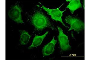 Immunofluorescence of monoclonal antibody to ALDOA on HeLa cell. (ALDOA 抗体  (AA 1-364))