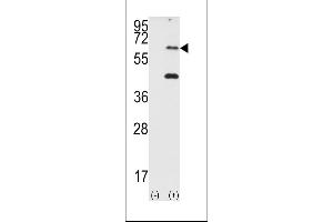 Western blot analysis of EIF2AK2 (arrow) using PRKR Antibody (N-term) (ABIN392778 and ABIN2837994). (EIF2AK2 抗体  (N-Term))