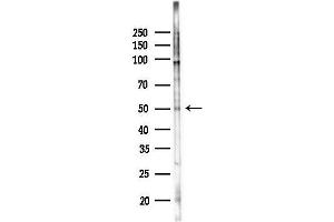 Western blot analysis of lysates from K562 cells(UV,30 min treatment), using Phospho-Src (Tyr419) Antibody at 1/1000 dilution.