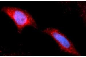 Immunofluorescence (IF) image for anti-Hexokinase 2 (HK2) (AA 1-917) antibody (APC) (ABIN5565592) (Hexokinase 2 抗体  (AA 1-917) (APC))