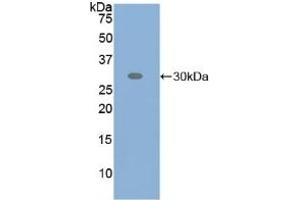 Detection of Recombinant ATF6, Human using Polyclonal Antibody to Activating Transcription Factor 6 (ATF6)
