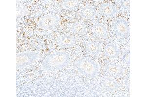 Immunohistochemistry (IHC) image for anti-Interferon alpha/beta Receptor 1 (IFNAR1) (AA 27-436) antibody (ABIN7795661)