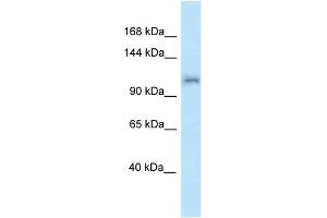 WB Suggested Anti-Zfr Antibody Titration: 1. (ZFR 抗体  (N-Term))