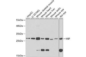 Western blot analysis of extracts of various cell lines, using MIP antibody (ABIN3016917, ABIN3016918, ABIN3016919 and ABIN6219879) at 1:1000 dilution. (Mip (AA 50-150) 抗体)