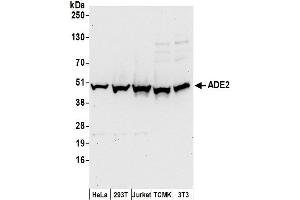 Western Blotting (WB) image for anti-phosphoribosylaminoimidazole Carboxylase, phosphoribosylaminoimidazole Succinocarboxamide Synthetase (PAICS) (AA 300-350) antibody (ABIN7453534)