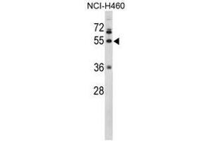 Image no. 1 for anti-Fibrinogen gamma Chain (FGG) (C-Term), (Chain gamma) antibody (ABIN453006)