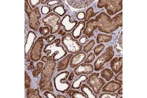 Immunohistochemical staining of human kidney with NDUFC1 polyclonal antibody  shows strong cytoplasmic positivity in cells in tubules. (NDUFC1 抗体)